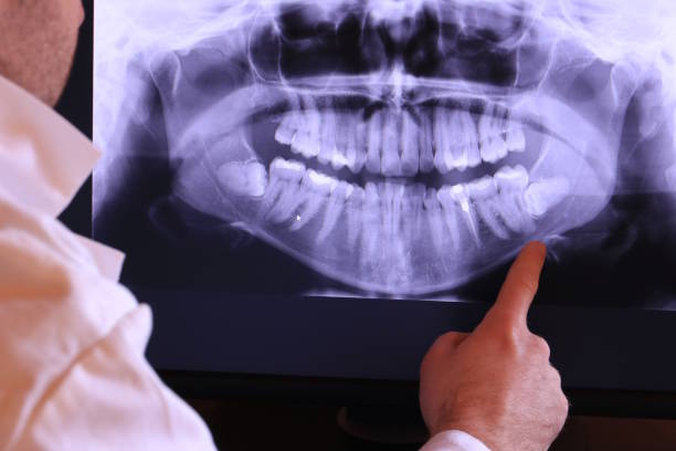 Best Knocked-Out Tooth Emergency  in Hartwell, GA